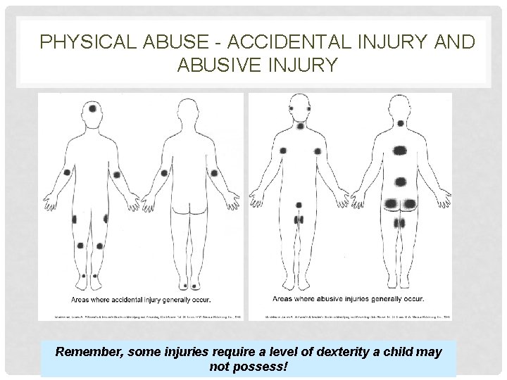 PHYSICAL ABUSE - ACCIDENTAL INJURY AND ABUSIVE INJURY Remember, some injuries require a level