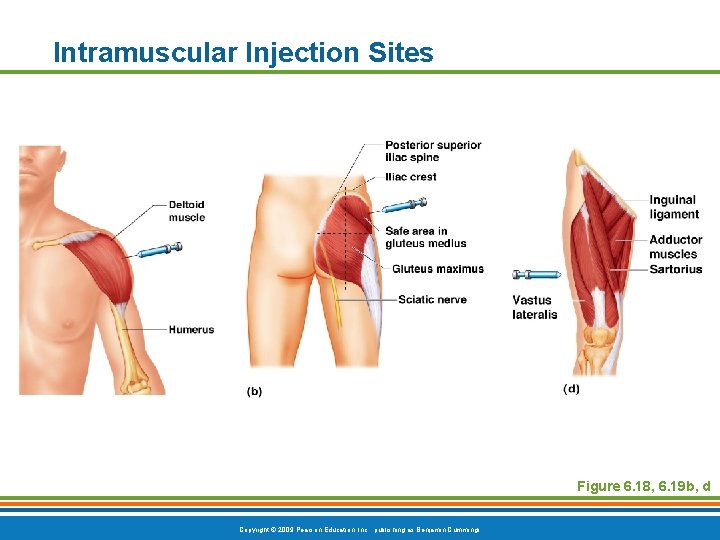 Intramuscular Injection Sites Figure 6. 18, 6. 19 b, d Copyright © 2009 Pearson