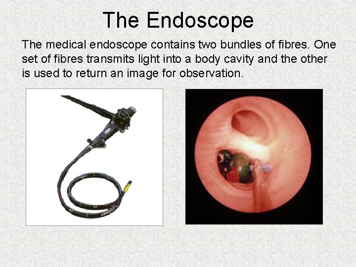 The Endoscope The medical endoscope contains two bundles of fibres. One set of fibres The Endoscope The medical endoscope contains two bundles of fibres. One set of fibres