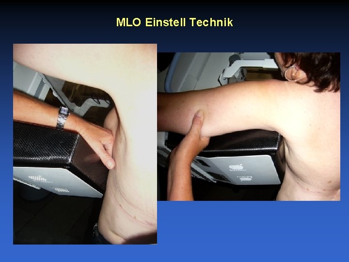 MLO Einstell Technik 