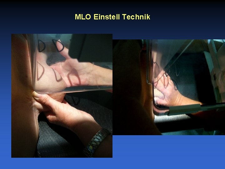 MLO Einstell Technik 