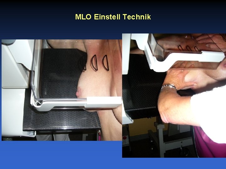 MLO Einstell Technik 