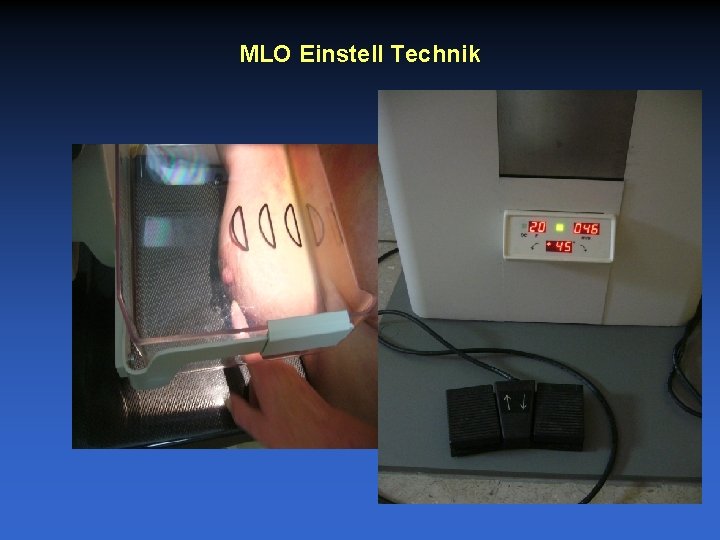 MLO Einstell Technik 