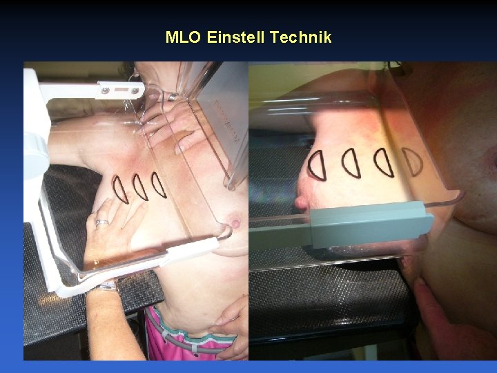 MLO Einstell Technik 