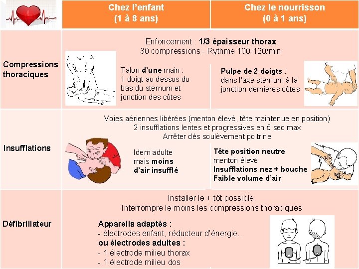 Chez l’enfant (1 à 8 ans) Chez le nourrisson (0 à 1 ans) Enfoncement