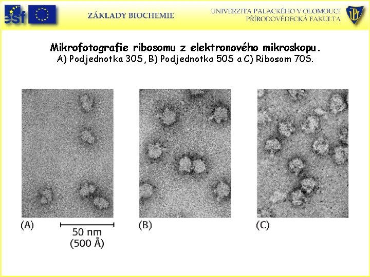 Mikrofotografie ribosomu z elektronového mikroskopu. A) Podjednotka 30 S, B) Podjednotka 50 S a