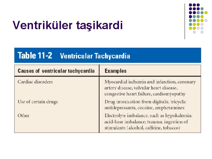 Ventriküler taşikardi 