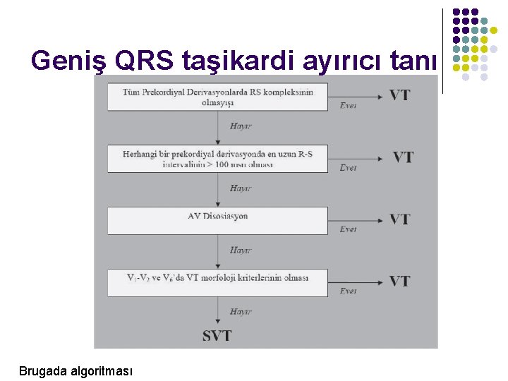 Geniş QRS taşikardi ayırıcı tanı Brugada algoritması 