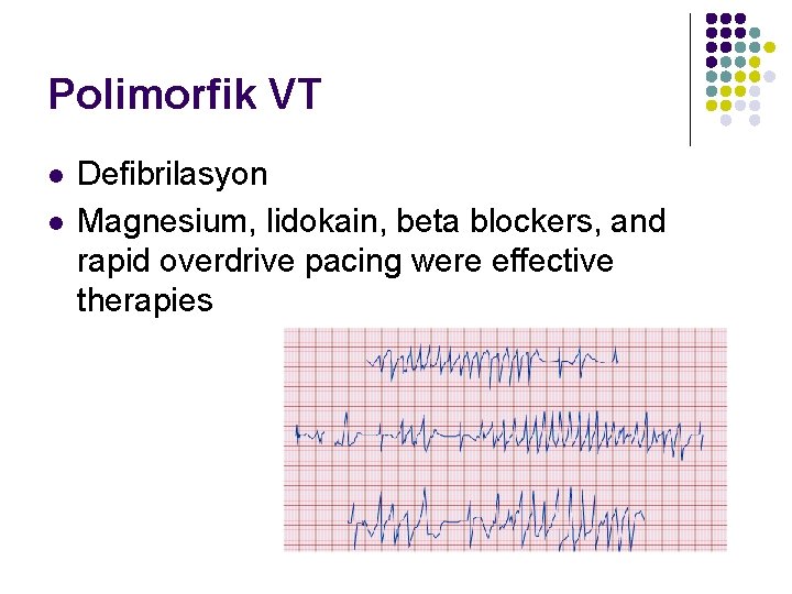 Polimorfik VT l l Defibrilasyon Magnesium, lidokain, beta blockers, and rapid overdrive pacing were