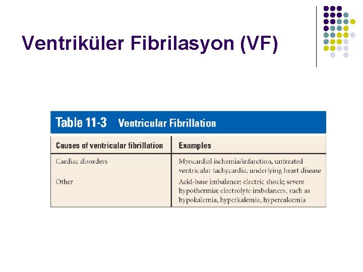 Ventriküler Fibrilasyon (VF) 