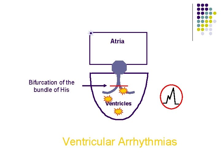 Atria Bifurcation of the bundle of His Ventricles Ventricular Arrhythmias 