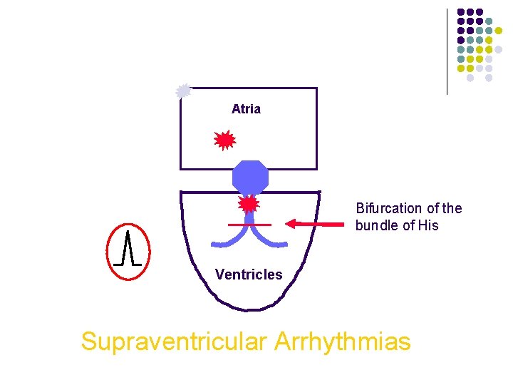 Atria Bifurcation of the bundle of His Ventricles Supraventricular Arrhythmias 