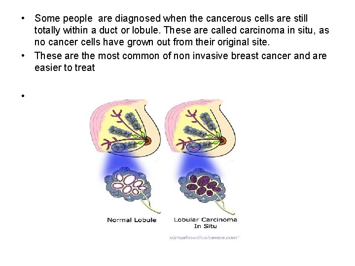  • Some people are diagnosed when the cancerous cells are still totally within