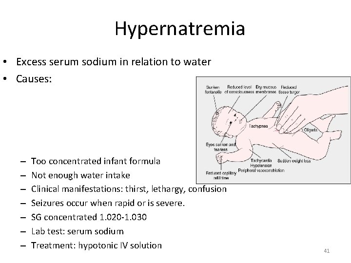 Hypernatremia • Excess serum sodium in relation to water • Causes: – – –