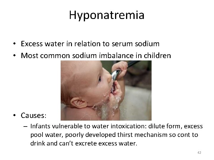 Hyponatremia • Excess water in relation to serum sodium • Most common sodium imbalance
