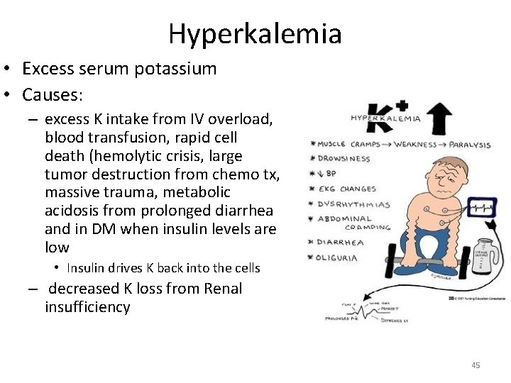 Hyperkalemia • Excess serum potassium • Causes: – excess K intake from IV overload,