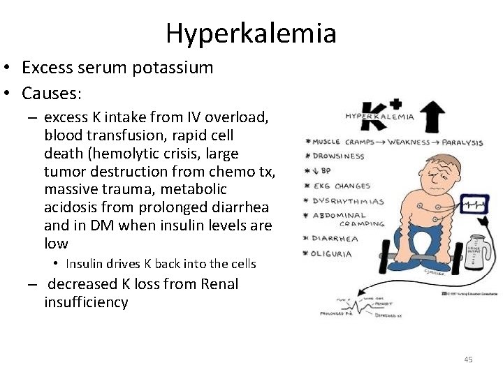 Hyperkalemia • Excess serum potassium • Causes: – excess K intake from IV overload, Hyperkalemia • Excess serum potassium • Causes: – excess K intake from IV overload,