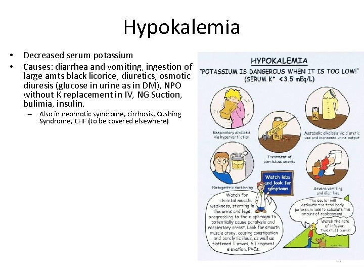 Hypokalemia • • Decreased serum potassium Causes: diarrhea and vomiting, ingestion of large amts