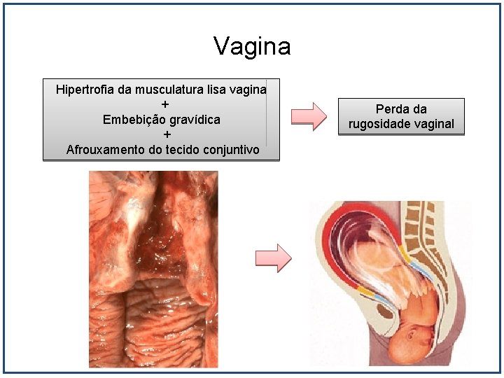 Vagina Hipertrofia da musculatura lisa vagina + Embebição gravídica + Afrouxamento do tecido conjuntivo