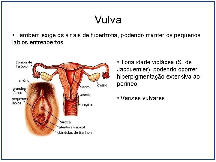 Vulva • Também exige os sinais de hipertrofia, podendo manter os pequenos lábios entreabertos