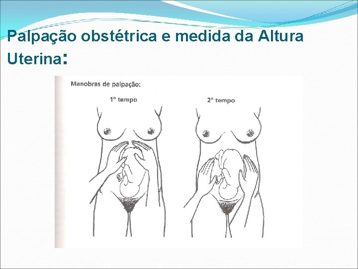 Palpação obstétrica e medida da Altura Uterina: 
