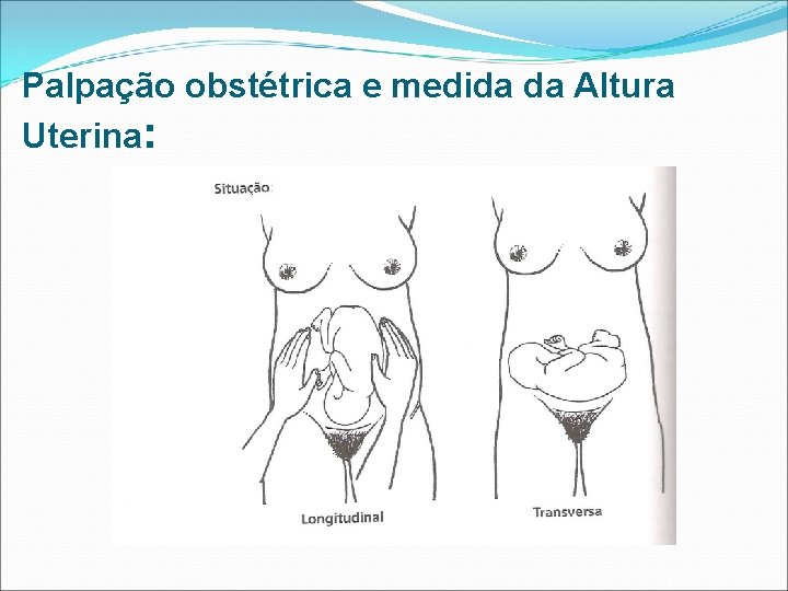Palpação obstétrica e medida da Altura Uterina: 