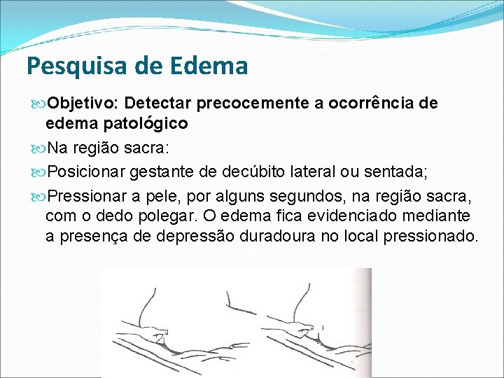 Pesquisa de Edema Objetivo: Detectar precocemente a ocorrência de edema patológico Na região sacra: