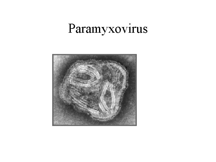 Paramyxovirus 