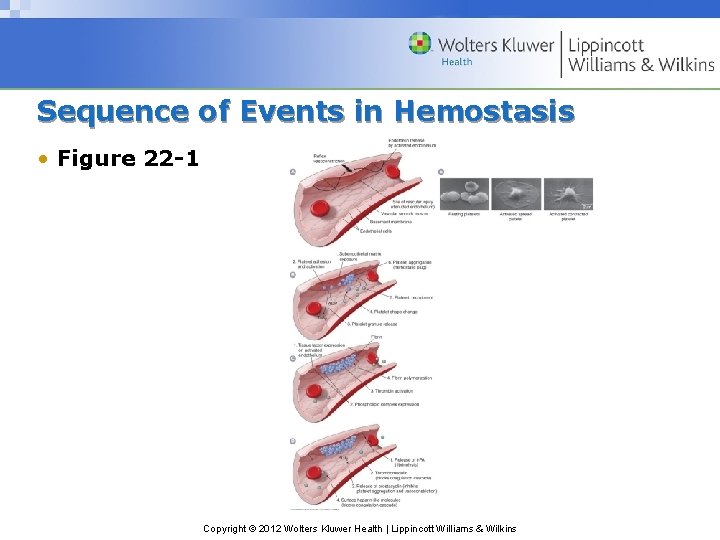 Sequence of Events in Hemostasis • Figure 22 -1 Copyright © 2012 Wolters Kluwer