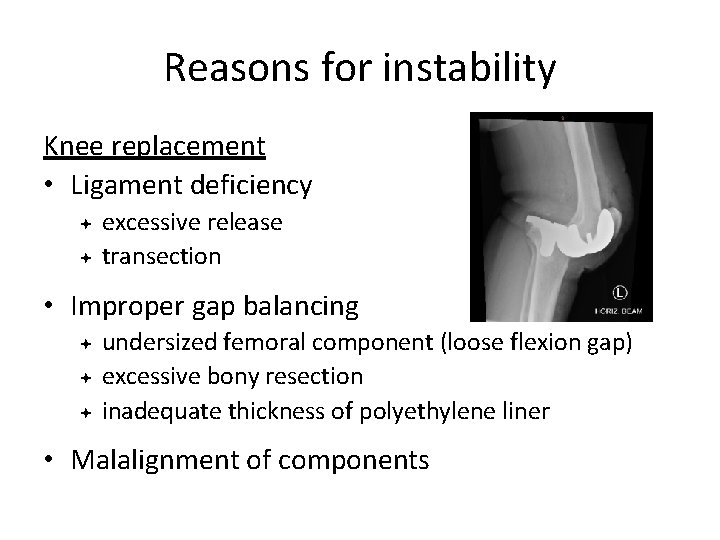 Reasons for instability Knee replacement • Ligament deficiency excessive release transection • Improper gap