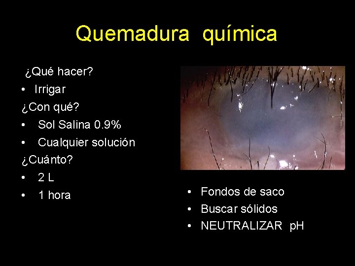 Quemadura química ¿Qué hacer? • Irrigar ¿Con qué? • Sol Salina 0. 9% •