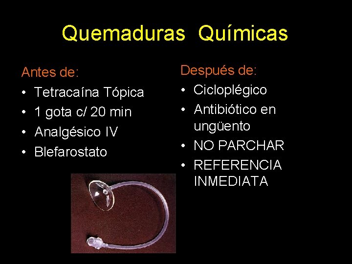 Quemaduras Químicas Antes de: • Tetracaína Tópica • 1 gota c/ 20 min •