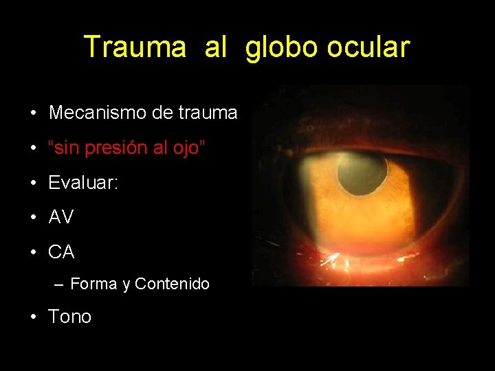 Trauma al globo ocular • Mecanismo de trauma • “sin presión al ojo” •