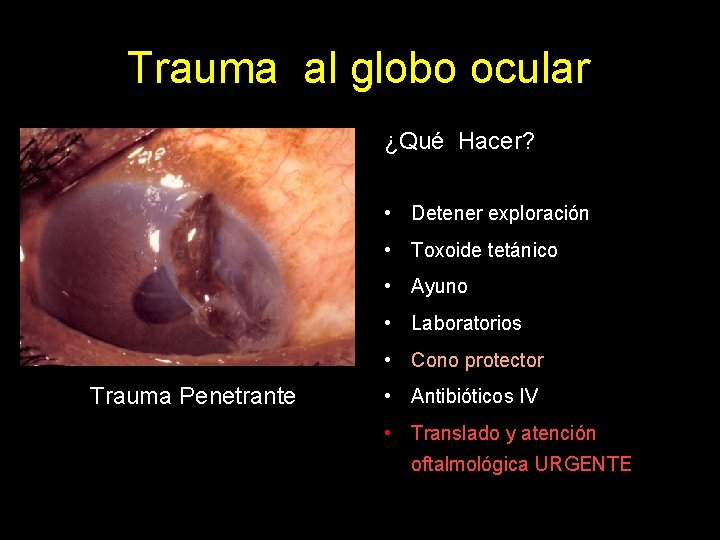 Trauma al globo ocular ¿Qué Hacer? • Detener exploración • Toxoide tetánico • Ayuno