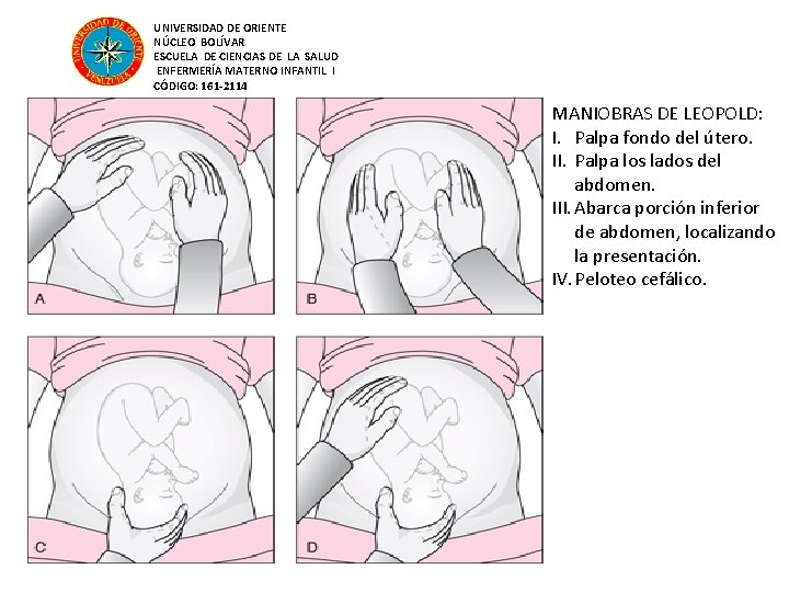 UNIVERSIDAD DE ORIENTE NÚCLEO BOLÍVAR ESCUELA DE CIENCIAS DE LA SALUD ENFERMERÍA MATERNO INFANTIL