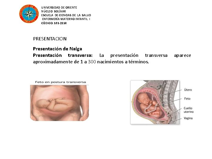 UNIVERSIDAD DE ORIENTE NÚCLEO BOLÍVAR ESCUELA DE CIENCIAS DE LA SALUD ENFERMERÍA MATERNO INFANTIL