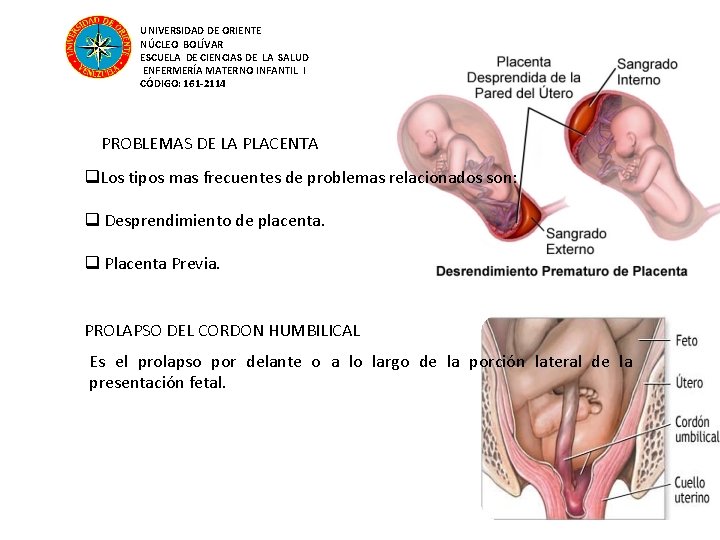 UNIVERSIDAD DE ORIENTE NÚCLEO BOLÍVAR ESCUELA DE CIENCIAS DE LA SALUD ENFERMERÍA MATERNO INFANTIL