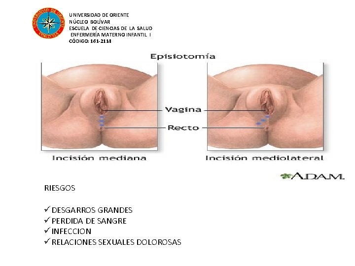 UNIVERSIDAD DE ORIENTE NÚCLEO BOLÍVAR ESCUELA DE CIENCIAS DE LA SALUD ENFERMERÍA MATERNO INFANTIL