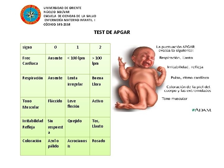 UNIVERSIDAD DE ORIENTE NÚCLEO BOLÍVAR ESCUELA DE CIENCIAS DE LA SALUD ENFERMERÍA MATERNO INFANTIL