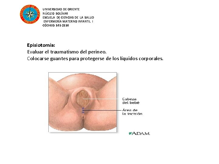UNIVERSIDAD DE ORIENTE NÚCLEO BOLÍVAR ESCUELA DE CIENCIAS DE LA SALUD ENFERMERÍA MATERNO INFANTIL
