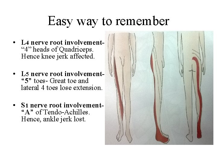 Easy way to remember • L 4 nerve root involvement“ 4” heads of Quadriceps.