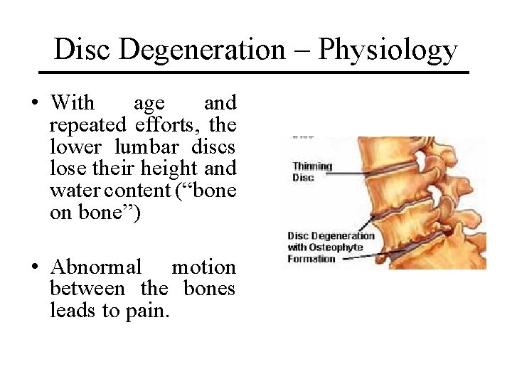 Disc Degeneration – Physiology • With age and repeated efforts, the lower lumbar discs