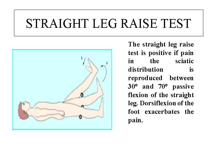 STRAIGHT LEG RAISE TEST STRAIGHT RAISE TEST The straight leg raise test is positive