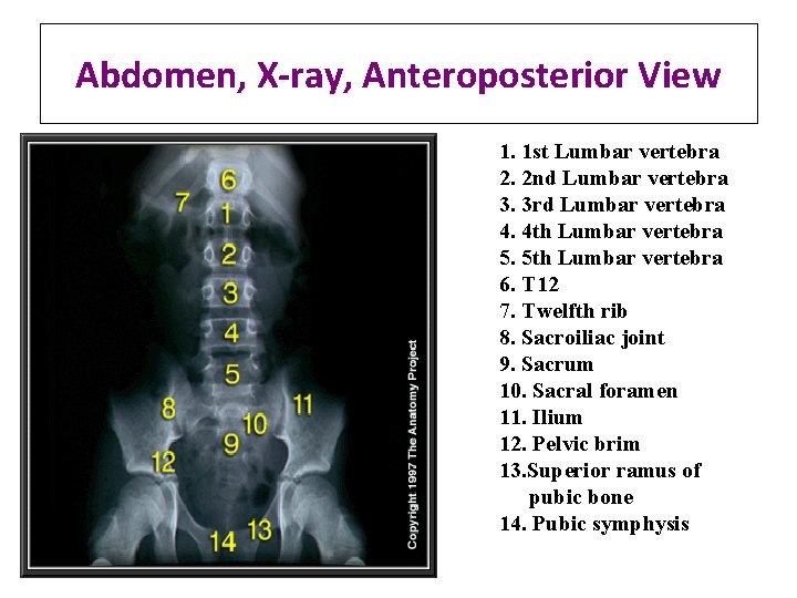 Abdomen, X-ray, Anteroposterior View 1. 1 st Lumbar vertebra 2. 2 nd Lumbar vertebra