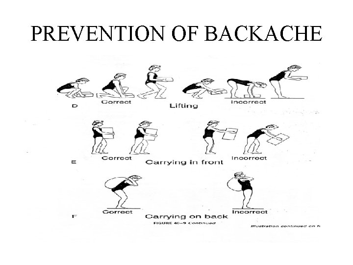 PREVENTION OF BACKACHE 