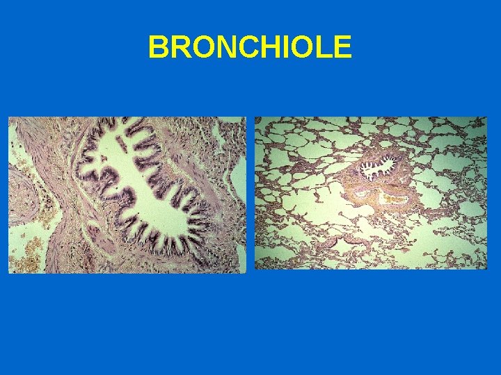 BRONCHIOLE 