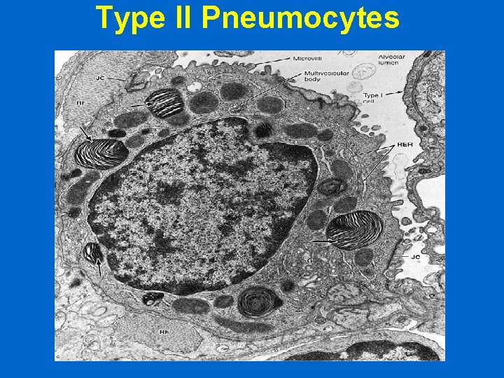 Type II Pneumocytes 