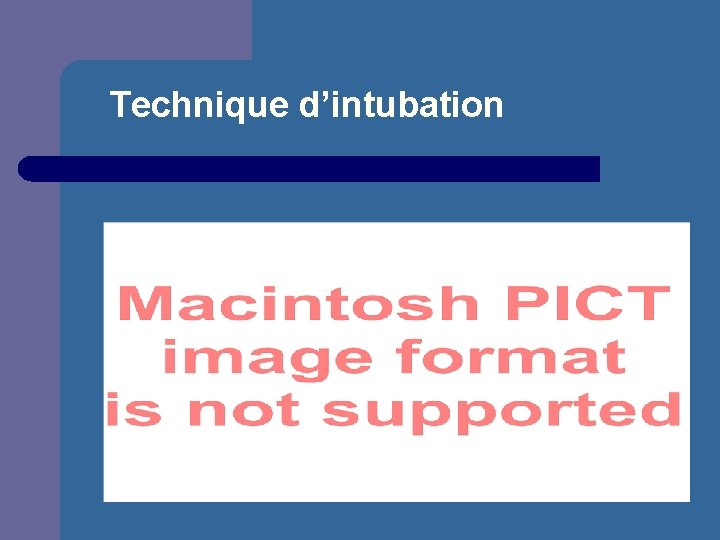 Technique d’intubation 