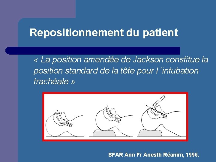 Repositionnement du patient « La position amendée de Jackson constitue la position standard de