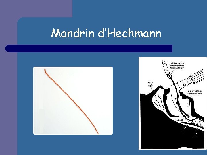 Mandrin d’Hechmann 